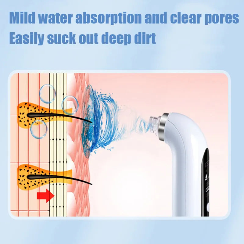 Blackhead Removal Pore Vacuum