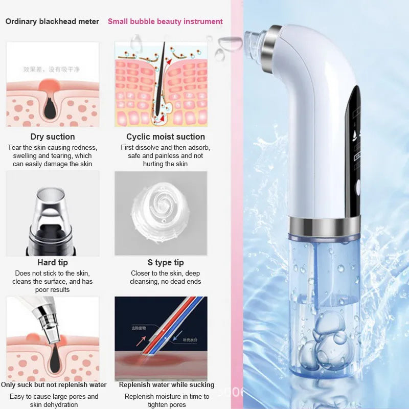 Blackhead Removal Pore Vacuum