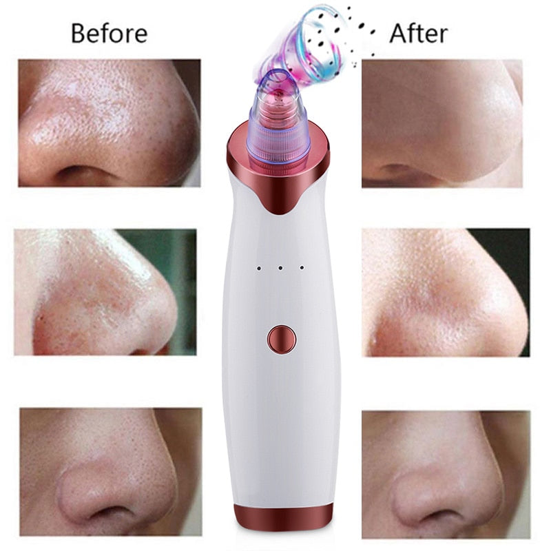 Electric Blackhead Vacuum Suction