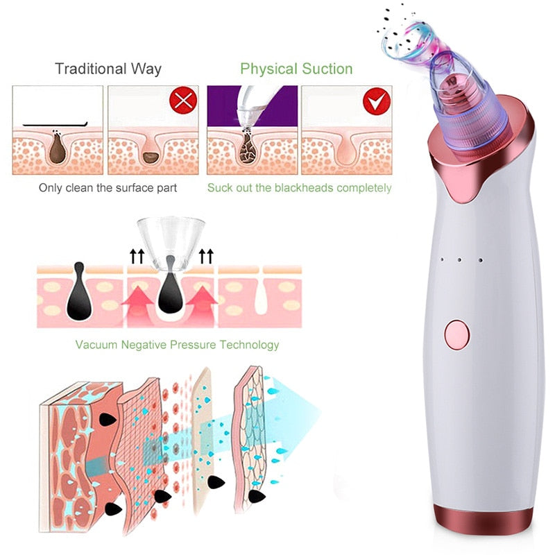 Electric Blackhead Vacuum Suction